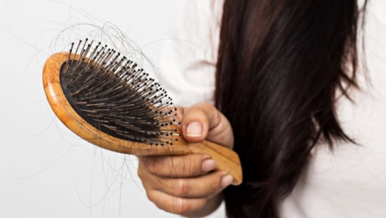 จับตายตัวร้ายต้นเหตุผมร่วง