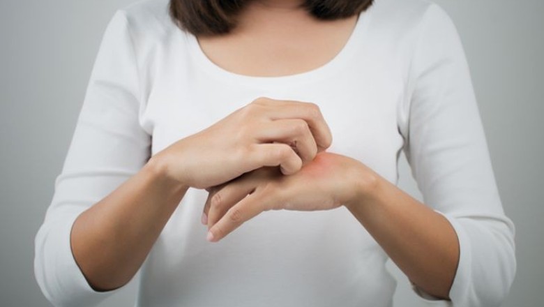 เมื่อแพ้นิกเกิ้ล